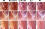 Punctate Highlight Removal for Microscopic Images Based on Pix2pixHD