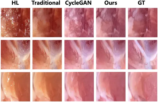 Punctate Highlight Removal for Microscopic Images Based on Pix2pixHD
